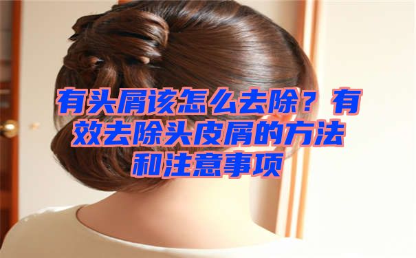 有头屑该怎么去除？有效去除头皮屑的方法和注意事项