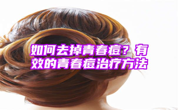 如何去掉青春痘？有效的青春痘治疗方法