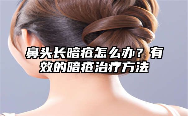 鼻头长暗疮怎么办？有效的暗疮治疗方法