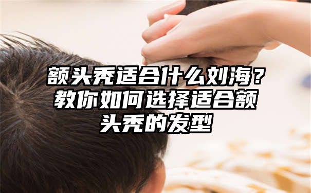 额头秃适合什么刘海？教你如何选择适合额头秃的发型