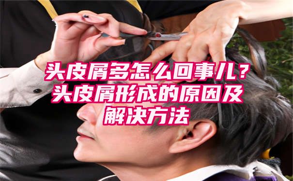 头皮屑多怎么回事儿？头皮屑形成的原因及解决方法