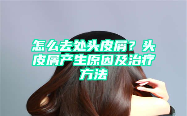 怎么去处头皮屑？头皮屑产生原因及治疗方法