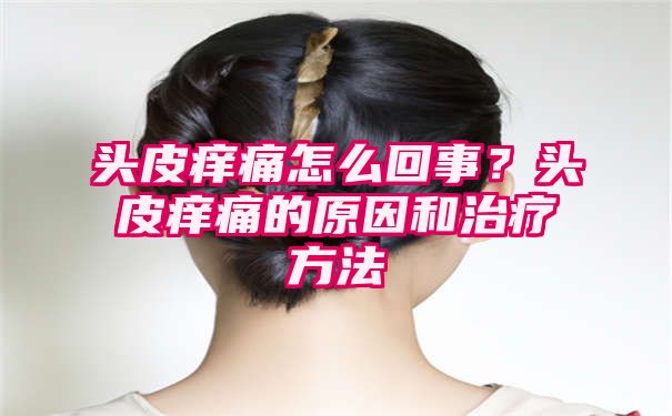 头皮痒痛怎么回事？头皮痒痛的原因和治疗方法