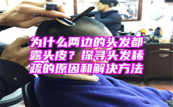 为什么两边的头发都露头皮？探寻头发稀疏的原因和解决方法