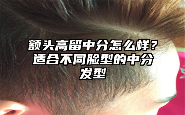 额头高留中分怎么样？适合不同脸型的中分发型