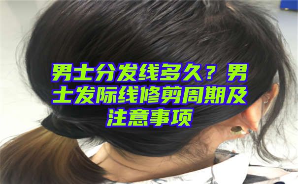 男士分发线多久？男士发际线修剪周期及注意事项