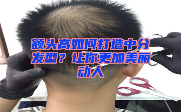 额头高如何打造中分发型？让你更加美丽动人