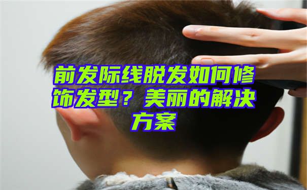 前发际线脱发如何修饰发型？美丽的解决方案