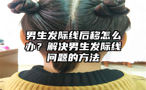 男生发际线后移怎么办？解决男生发际线问题的方法