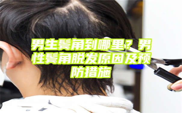 男生鬓角到哪里？男性鬓角脱发原因及预防措施