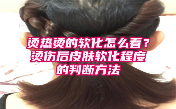 烫热烫的软化怎么看？烫伤后皮肤软化程度的判断方法