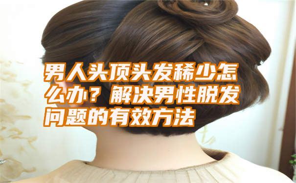 男人头顶头发稀少怎么办？解决男性脱发问题的有效方法