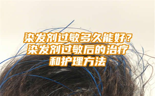 染发剂过敏多久能好？染发剂过敏后的治疗和护理方法